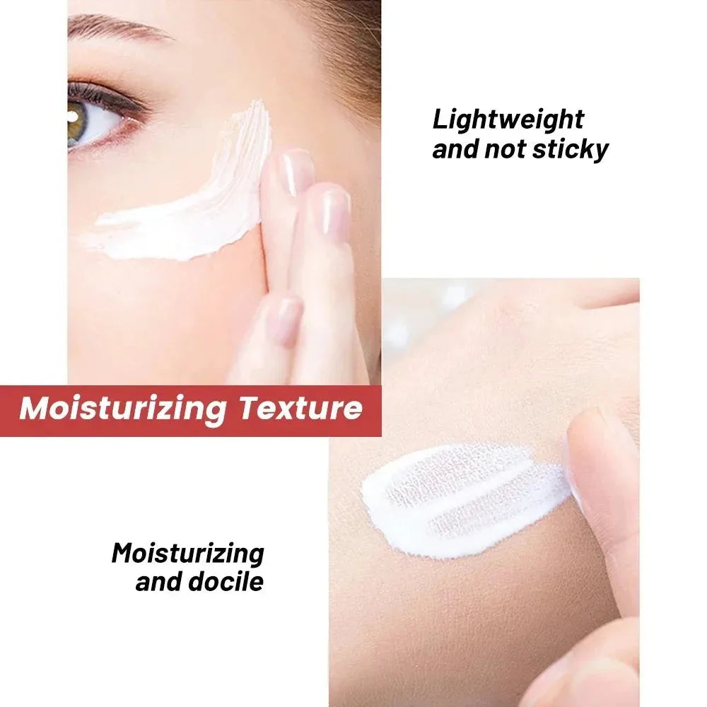 1/3/5pcs Whitening Freckle Cream Niacinamide Remove Dark Spot Cream Anti Freckle and Aging Cream Fade Pigmentation Melasma Skin Aurora Glow Avenue