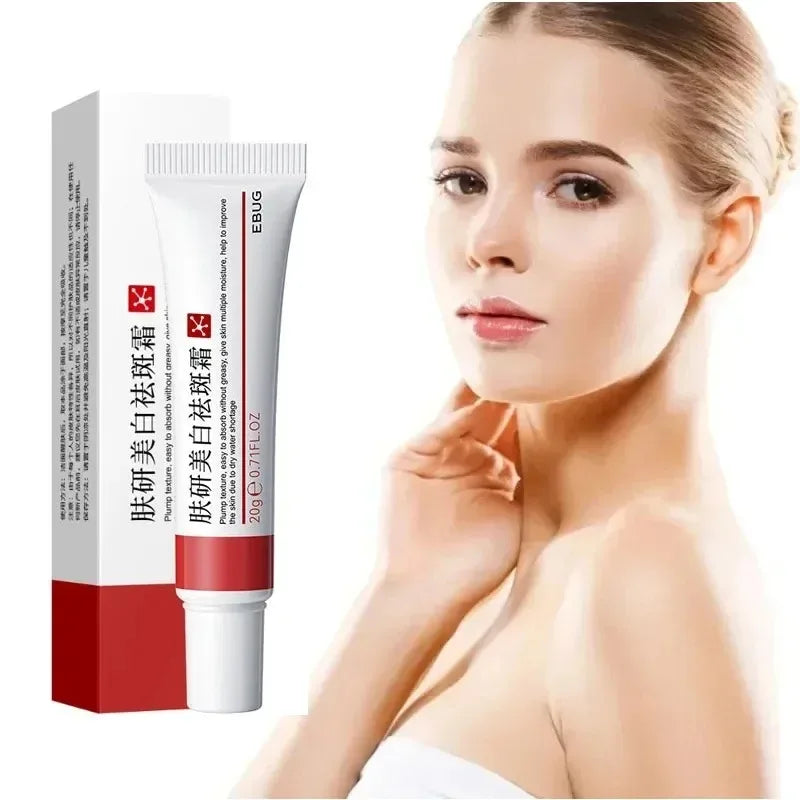 1/3/5pcs Whitening Freckle Cream Niacinamide Remove Dark Spot Cream Anti Freckle and Aging Cream Fade Pigmentation Melasma...