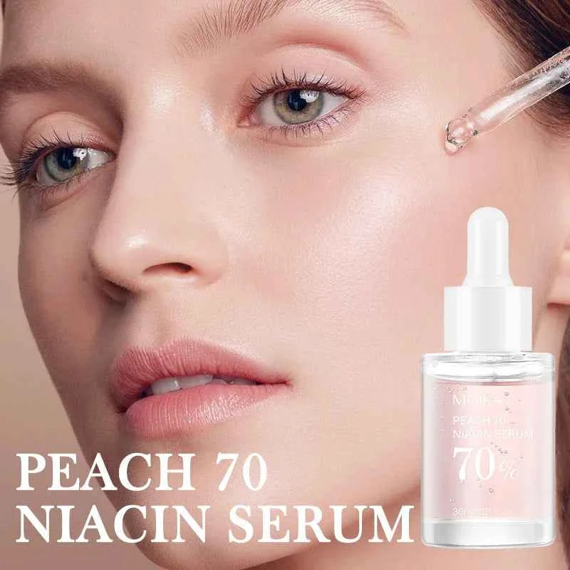 Niacinamide Serum Dark Spot Remover Fade Acne Marks Hyperpigmentation Shrink Pores Even Skin Tone Moisturizing Korea Skin ...