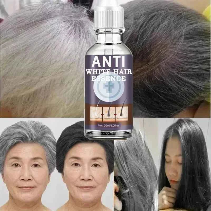 White hair killer, remove gray hair and restore natural hair color in 7 days
