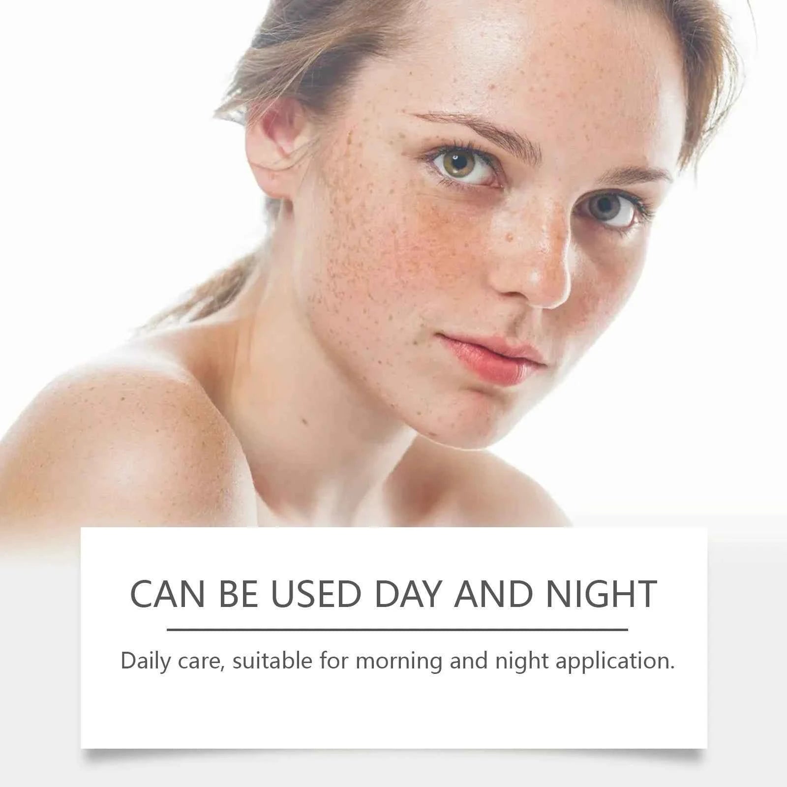 SADOER Anti Freckle Cream Face Whitening Creams Spot Removing Anti-aging Moisturizing Freckles Removal Facial Cream Skin C...