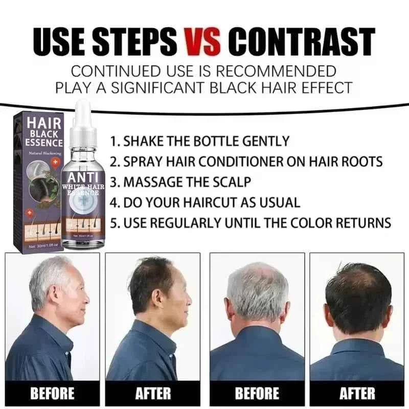 White hair killer, remove gray hair and restore natural hair color in 7 days