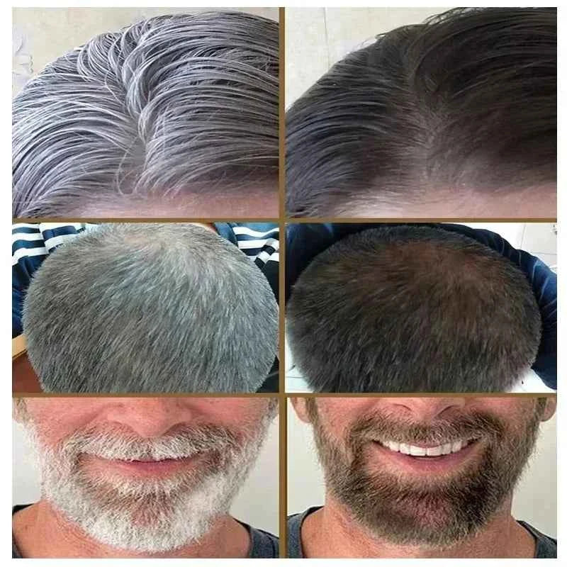 White hair killer, remove gray hair and restore natural hair color in 7 days