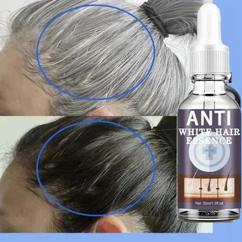 White hair killer, remove gray hair and restore natural hair color in 7 days - 