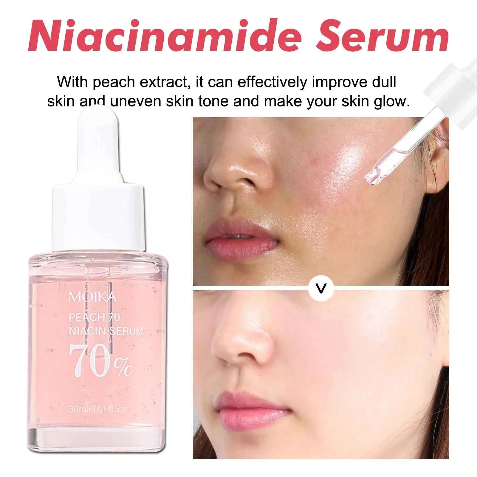 Niacinamide Serum Dark Spot Remover Fade Acne Marks Hyperpigmentation Shrink Pores Even Skin Tone Moisturizing Korea Skin ...