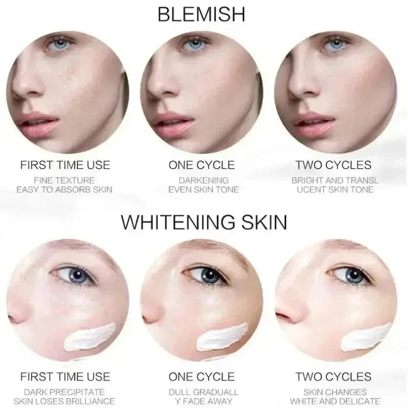 1/3/5pcs Whitening Freckle Cream Niacinamide Remove Dark Spot Cream Anti Freckle and Aging Cream Fade Pigmentation Melasma Skin Aurora Glow Avenue